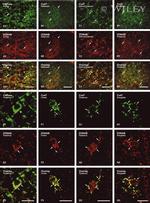 Connexin 32 Antibody in Immunohistochemistry (IHC)