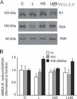 NMDAR1 Antibody in Western Blot (WB)