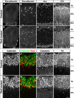 EOMES Antibody in Immunohistochemistry (IHC)