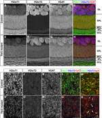 EOMES Antibody in Immunohistochemistry (IHC)