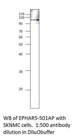 Ephrin Receptor A5 Antibody in Western Blot (WB)