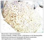 Ephrin Receptor B1 Antibody in Immunohistochemistry (IHC)