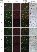 Estrogen Receptor alpha Antibody in Immunohistochemistry (IHC)