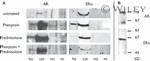 Estrogen Receptor alpha Antibody in Western Blot (WB)