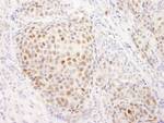 Estrogen Receptor Alpha Antibody in Immunohistochemistry (IHC)