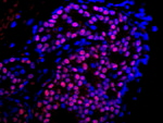 Estrogen Receptor Alpha Antibody in Immunohistochemistry (IHC)