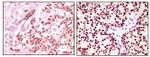 Estrogen Receptor alpha Antibody in Immunohistochemistry (Paraffin) (IHC (P))