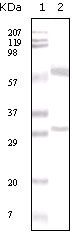 Estrogen Receptor alpha Antibody in Western Blot (WB)