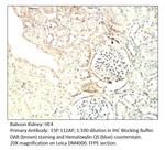 HE4 Antibody in Immunohistochemistry (IHC)