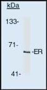 Estrogen Receptor alpha Antibody in Western Blot (WB)