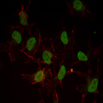 Estrogen Receptor alpha Antibody in Immunocytochemistry (ICC/IF)