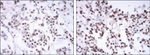 Estrogen Receptor alpha Antibody in Immunohistochemistry (Paraffin) (IHC (P))