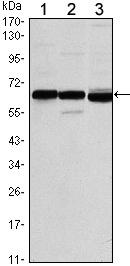 Estrogen Receptor alpha Antibody in Western Blot (WB)