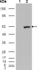 ETV1 Antibody in Western Blot (WB)