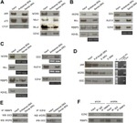 EZH2 Antibody in Western Blot, Immunoprecipitation (WB, IP)