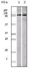 EphA1 Antibody in Western Blot (WB)