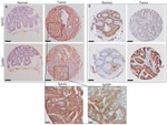 EphA2 Antibody in Immunohistochemistry (Paraffin) (IHC (P))