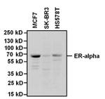 Estrogen Receptor alpha Antibody in Western Blot (WB)