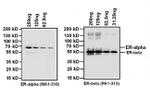 Estrogen Receptor alpha Antibody in Western Blot (WB)