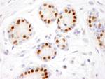 Estrogen Receptor Alpha Antibody in Immunohistochemistry (IHC)