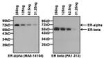 Estrogen Receptor alpha Antibody in Western Blot (WB)