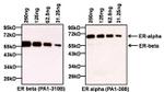 Estrogen Receptor beta Antibody in Western Blot (WB)