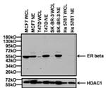 Estrogen Receptor beta Antibody in Western Blot (WB)