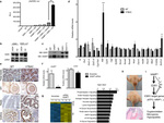 Estrogen Receptor alpha Antibody in Western Blot, Immunoprecipitation (WB, IP)