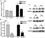 Estrogen Receptor beta Antibody in Western Blot (WB)