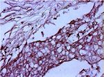 Ezrin Antibody in Immunohistochemistry (Paraffin) (IHC (P))