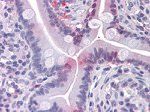 FABP2 Antibody in Immunohistochemistry (Paraffin) (IHC (P))