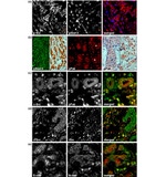 Phospho-FAK (Tyr861) Antibody in Immunohistochemistry (IHC)