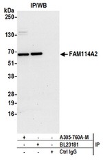 FAM114A2 Antibody in Western Blot (WB)