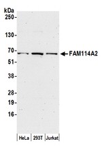 FAM114A2 Antibody in Western Blot (WB)