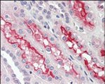 FER Antibody in Immunohistochemistry (Paraffin) (IHC (P))