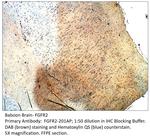 FGFR2 Antibody in Immunohistochemistry (IHC)