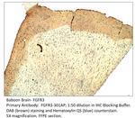 FGFR3 Antibody in Immunohistochemistry (IHC)