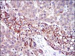 Fibrinogen gamma Antibody in Immunohistochemistry (Paraffin) (IHC (P))