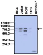 FOXP1 Antibody in Western Blot (WB)