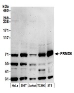 FRMD6 Antibody in Western Blot (WB)