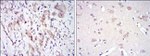 Fyn Antibody in Immunohistochemistry (Paraffin) (IHC (P))