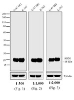 Mouse IgG (H+L) Cross-Adsorbed Secondary Antibody in Western Blot (WB)