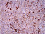 G6PD Antibody in Immunohistochemistry (Paraffin) (IHC (P))