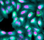 Mouse IgG (H+L) Highly Cross-Adsorbed Secondary Antibody in Immunocytochemistry (ICC/IF)