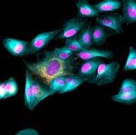 Mouse IgG (H+L) Highly Cross-Adsorbed Secondary Antibody in Immunocytochemistry (ICC/IF)