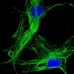 Mouse IgG (H+L) Highly Cross-Adsorbed Secondary Antibody in Immunocytochemistry (ICC/IF)