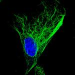 Mouse IgG (H+L) Highly Cross-Adsorbed Secondary Antibody in Immunocytochemistry (ICC/IF)