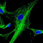 Mouse IgG (H+L) Highly Cross-Adsorbed Secondary Antibody in Immunocytochemistry (ICC/IF)