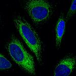 Mouse IgG (H+L) Highly Cross-Adsorbed Secondary Antibody in Immunocytochemistry (ICC/IF)