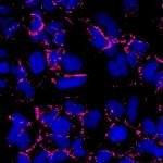 Mouse IgG (H+L) Highly Cross-Adsorbed Secondary Antibody in Immunocytochemistry (ICC/IF)